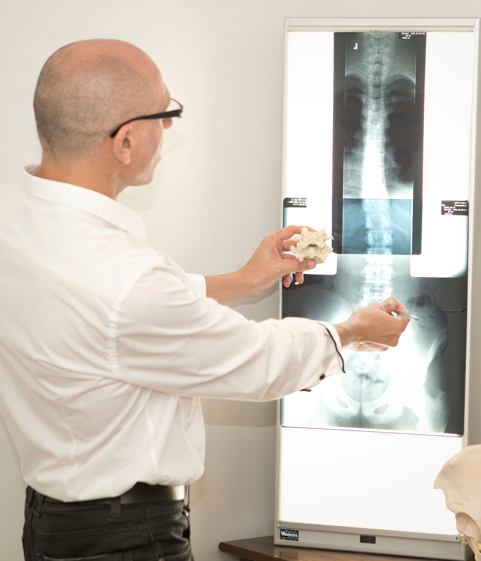 Chiropractic Effective for Scoliosis
