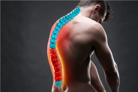 Thoracic Kyphosis: Everything You Need to Know