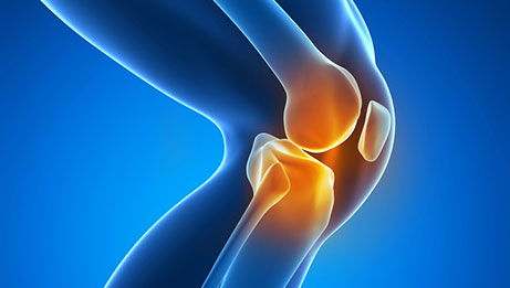 Why Do My Knees Pop Degenerative-oa Of The Knee Joints